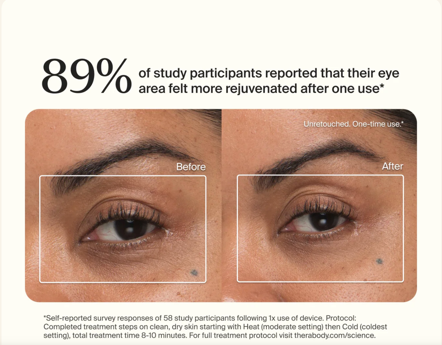 TheraFace Depuffing Wand - White