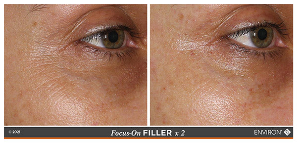 3D Synergie Filler Creme